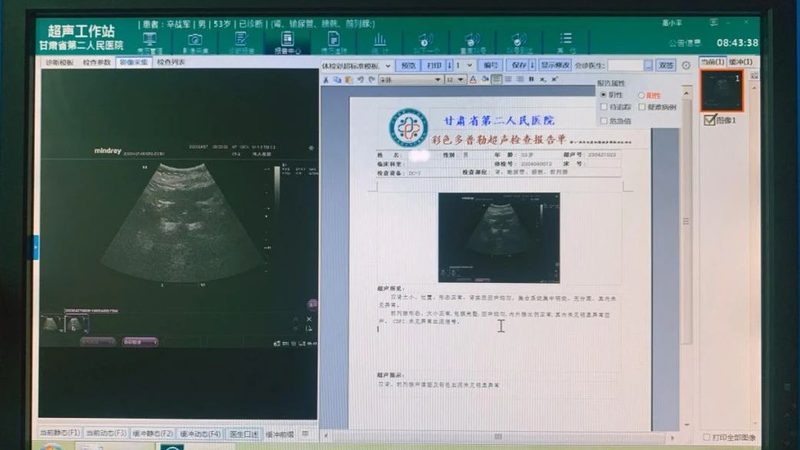 高龄孕妇孕前染色体检查：了解、意义与注意事项